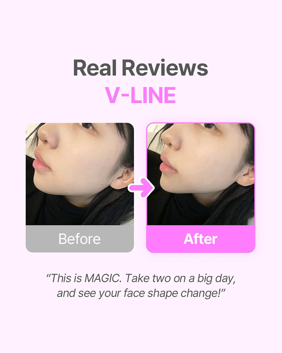 Promotional graphic for a V-line face shaping product, showing before and after side-profile photos of a woman's face with text reading 'Real Reviews V-LINE' and a quote at the bottom.