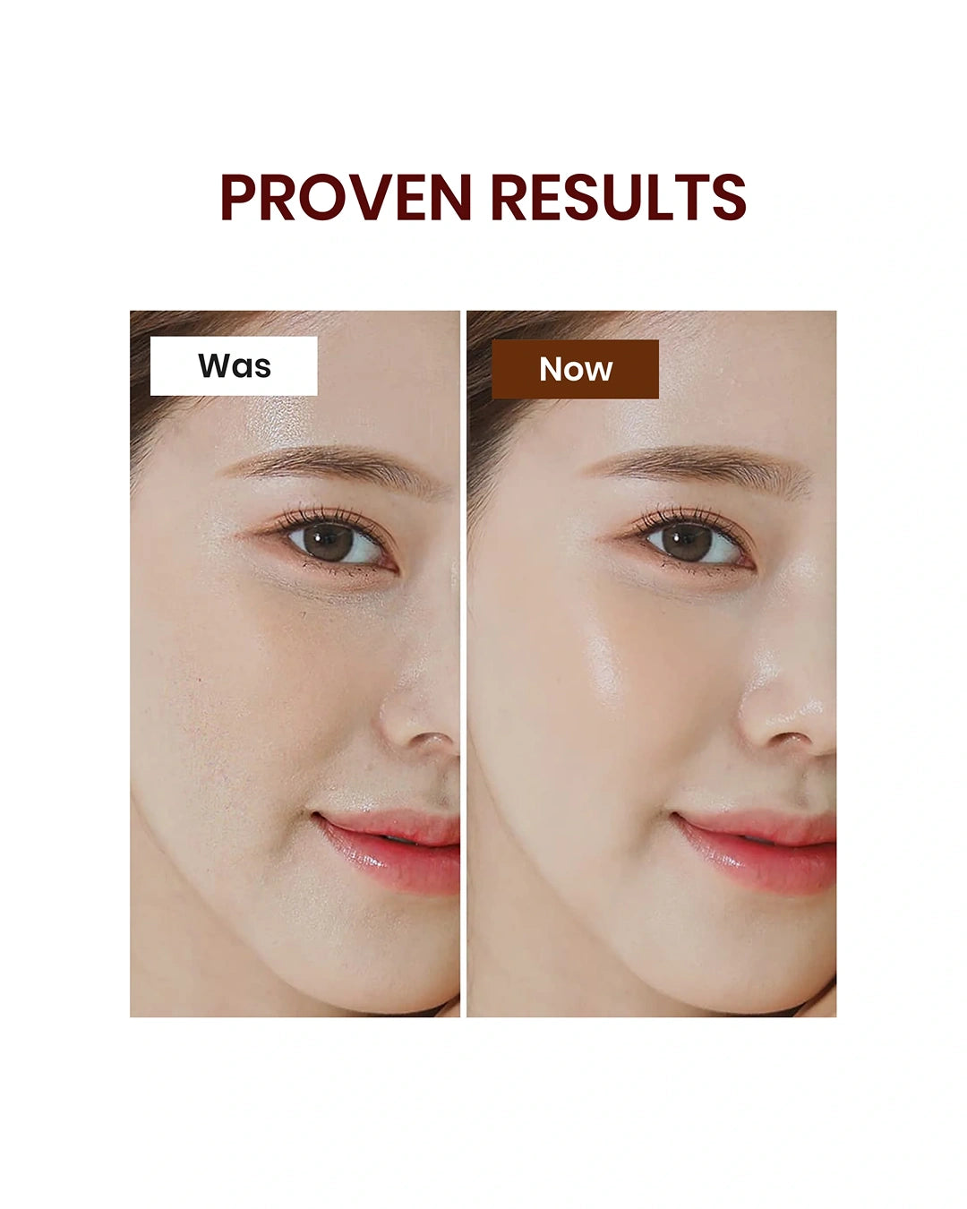 Before-and-after skin comparison graphic with the text 'PROVEN RESULTS' above two close-up facial photos labeled 'Was' and 'Now' on a white background.