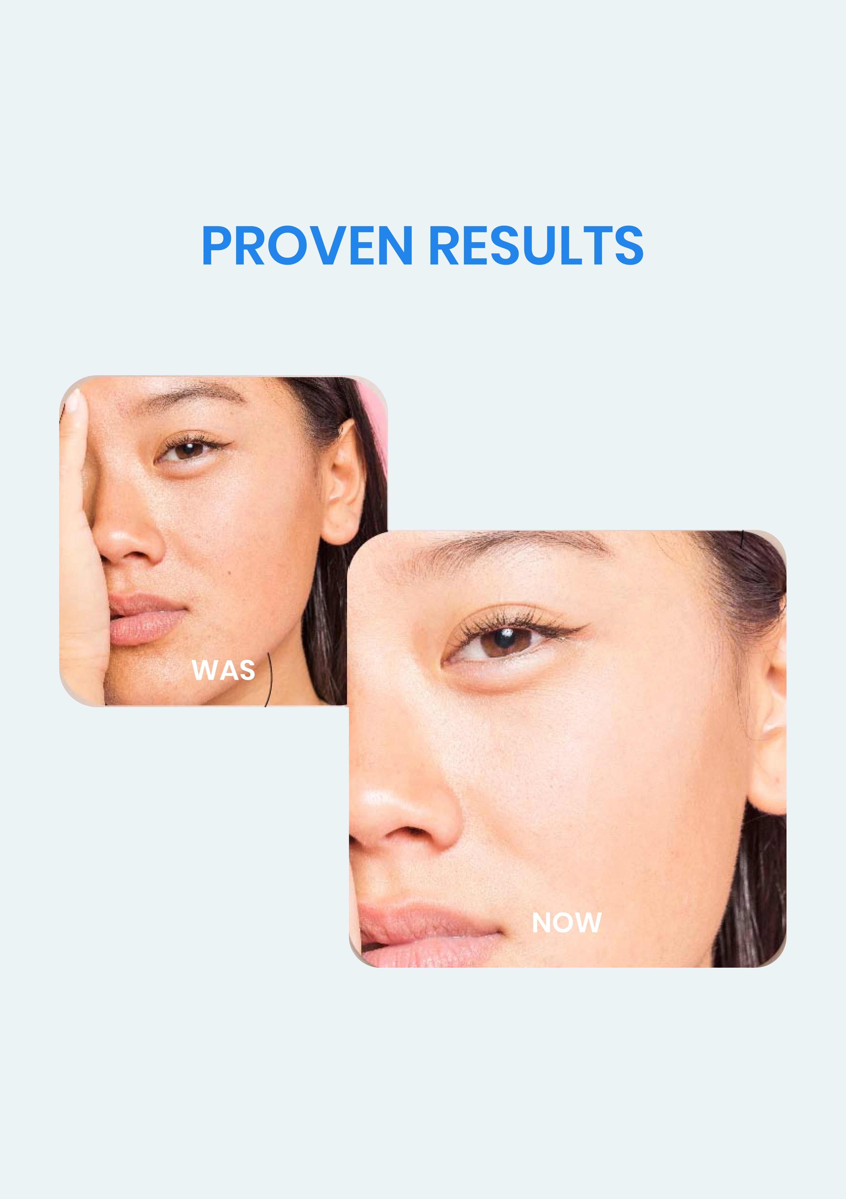 Before and after comparison of a woman's face with text 'Proven Results' on a light blue background.